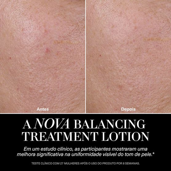 Lo&ccedil;&atilde;o Facial La Mer The Balancing Treatment Lotion